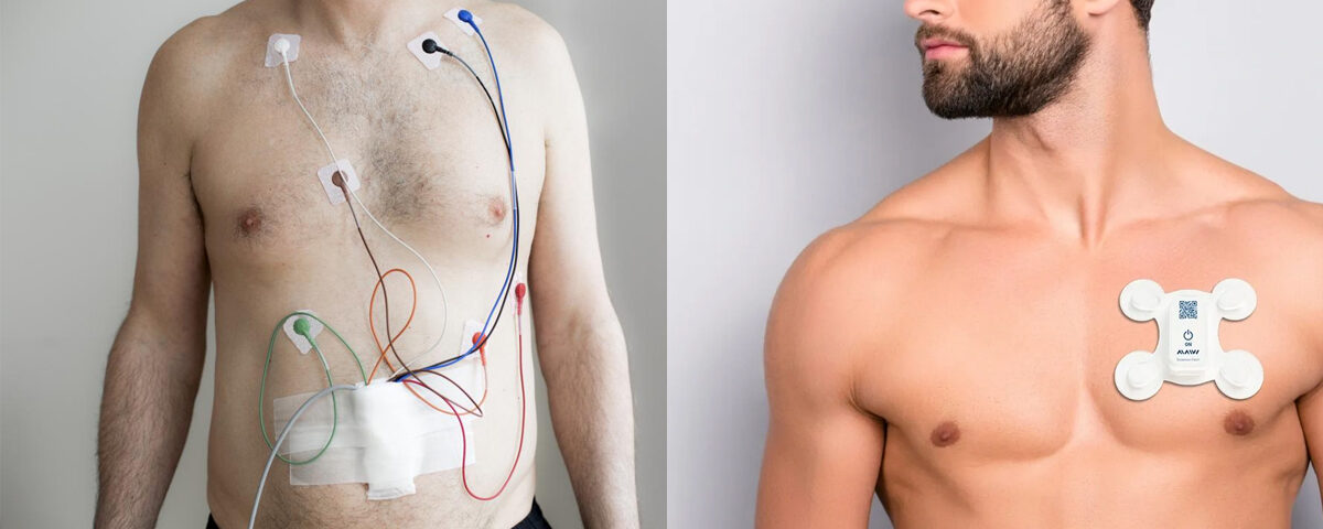 Holter-Monitoring Holter-Monitoring