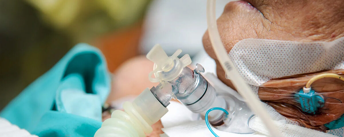 Tracheostomy-Tube-Change Tracheostomy-Tube-Change