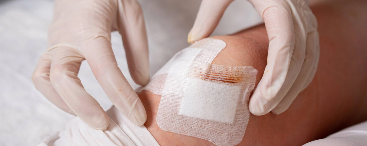 Wound-Dressing Wound-Dressing
