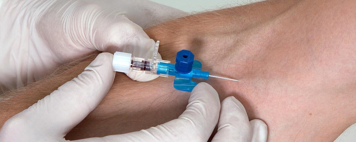 IV-Cannulation IV-Cannulation